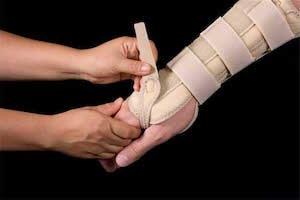 Broken arm